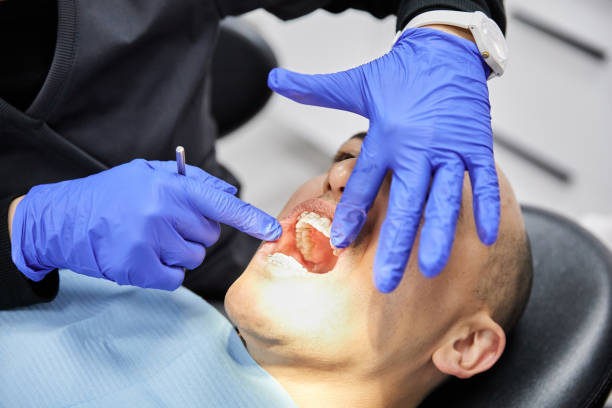 Best Dental Abscess Treatment in Lewiston, UT